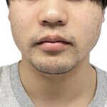 COさん