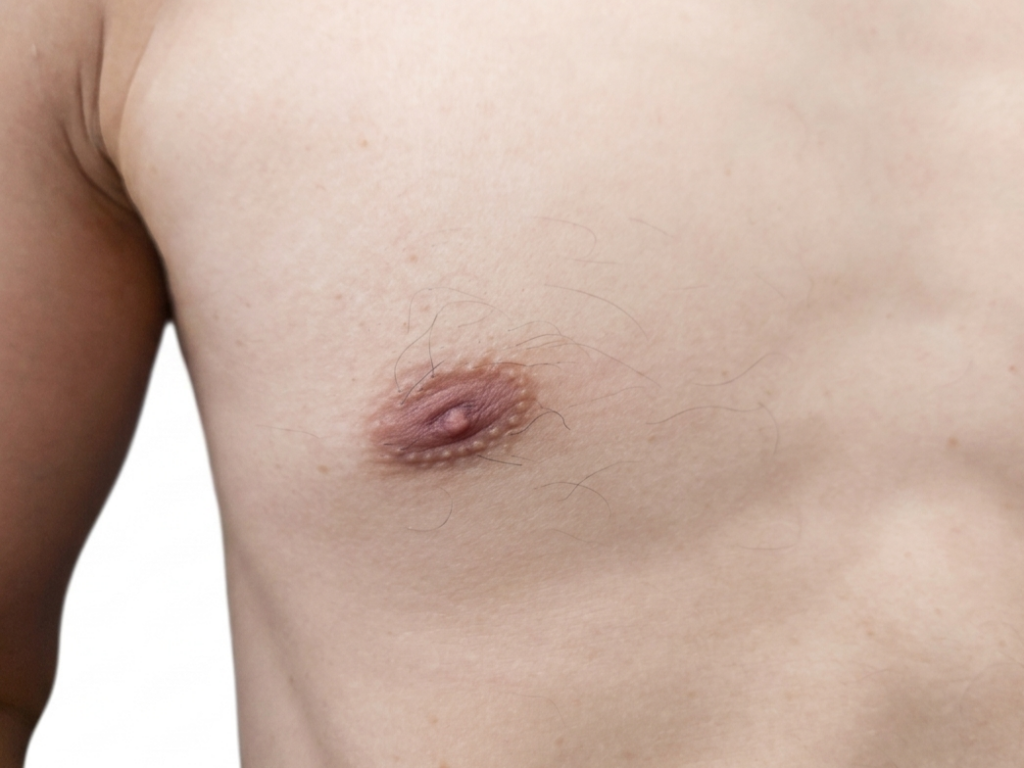 全身脱毛から４年経過した胸毛の状態【写真】（胸毛脱毛10回：乳輪回り8回）