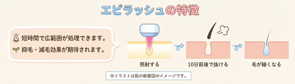 メンズTBCのエピラッシュをイメージした画像
